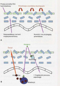 Rys. 1  Przyczyna AZS  Źródło: D. Nowicka „Dermatologia”